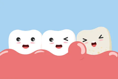 periodontitis-or-gum-disease-with-bleeding-cute-cartoon-tooth-character-with-gum-problem-vector
