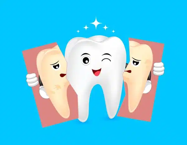 Dentals way blog