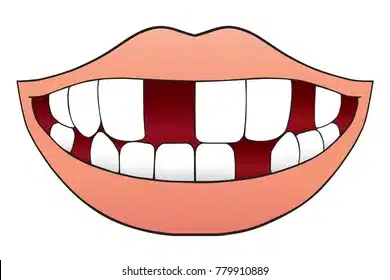 smiling-cartoon-mouth-several-missing