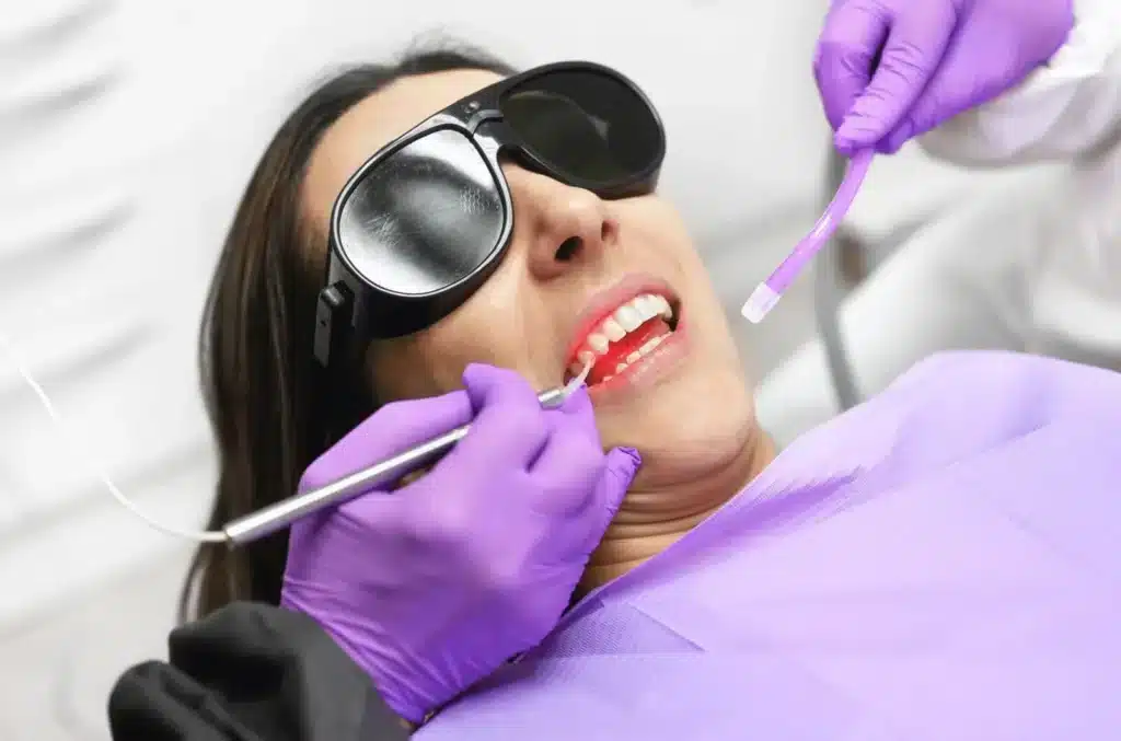 Leading Guide on Laser Dentistry