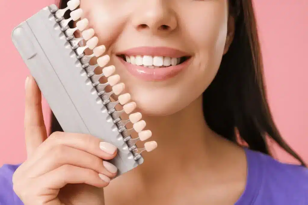 Patient Matching Veneers to Natural Teeth