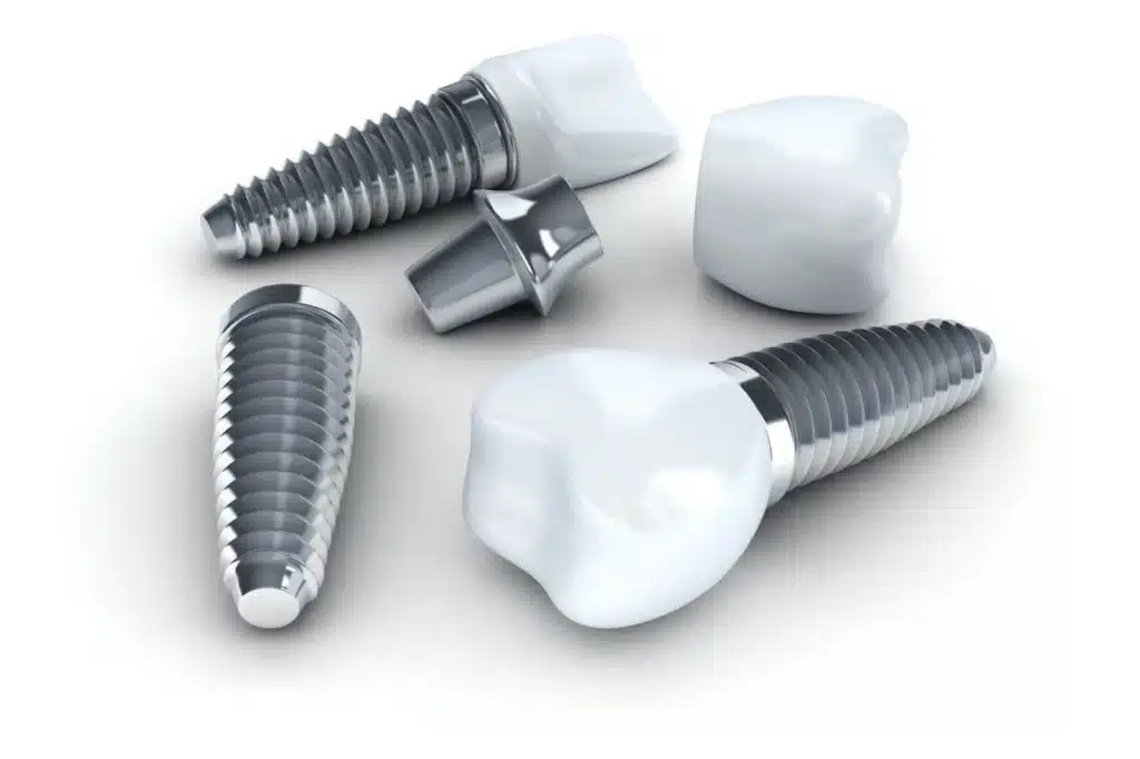 Single Dental Implants Model