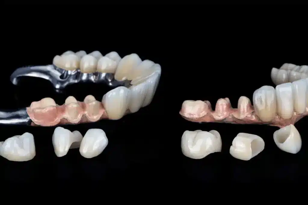 Dental Crowns for Teeth