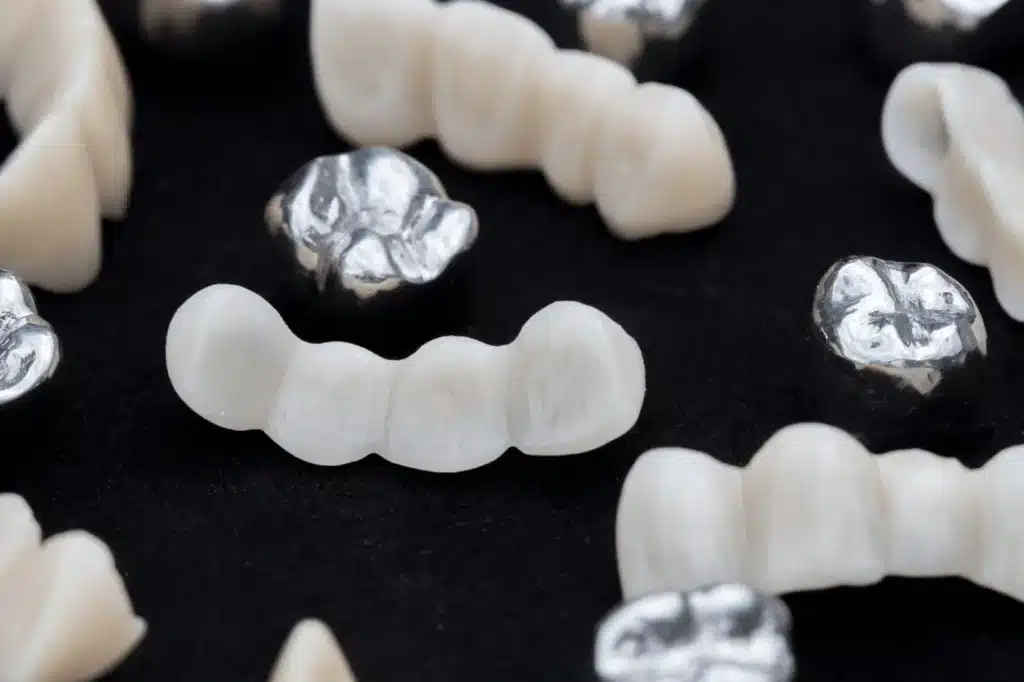 Dental Crowns