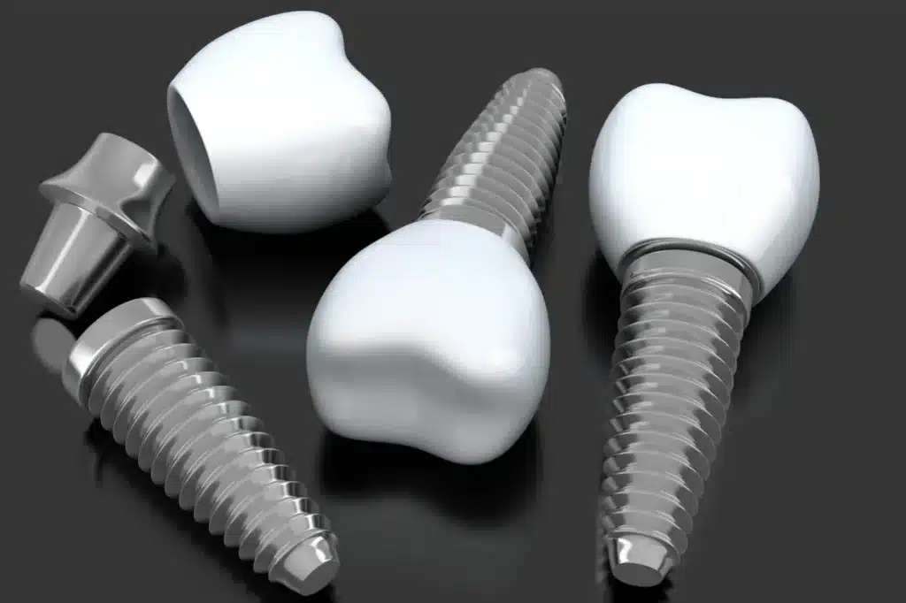 Dental Implants