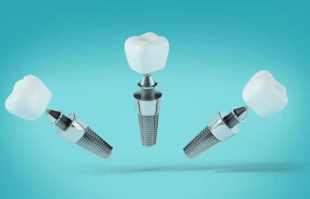 Single Dental Implants