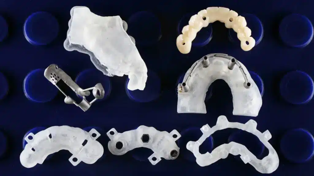 Zygomatic Implant Preparation Process