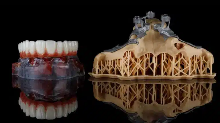 Zygomatic Implant