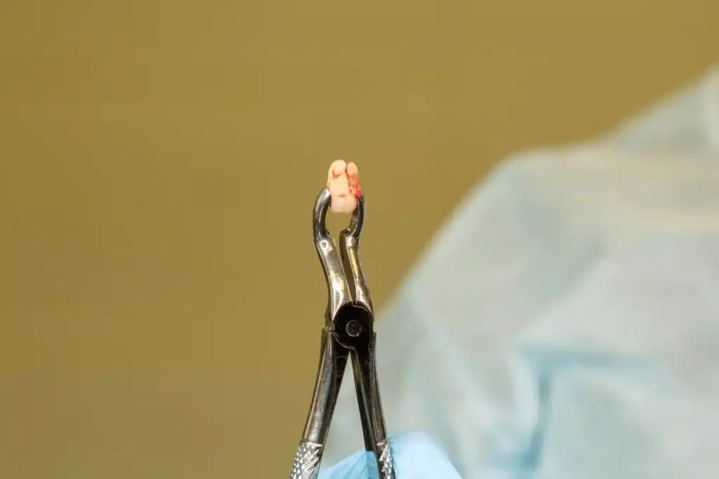 Dentist Holding Extracted Tooth