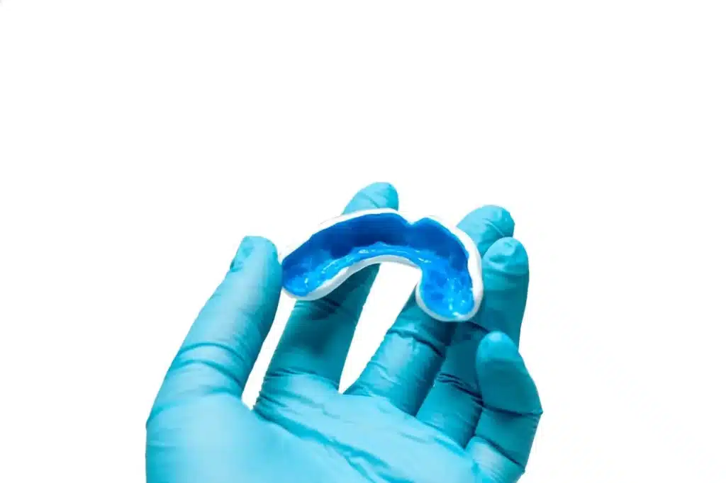 Cost of Mouthguards Abroad