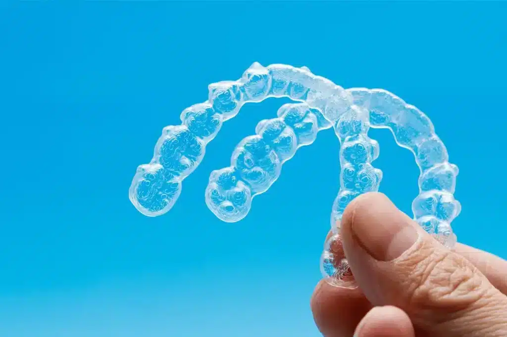 Invisalign Procedure