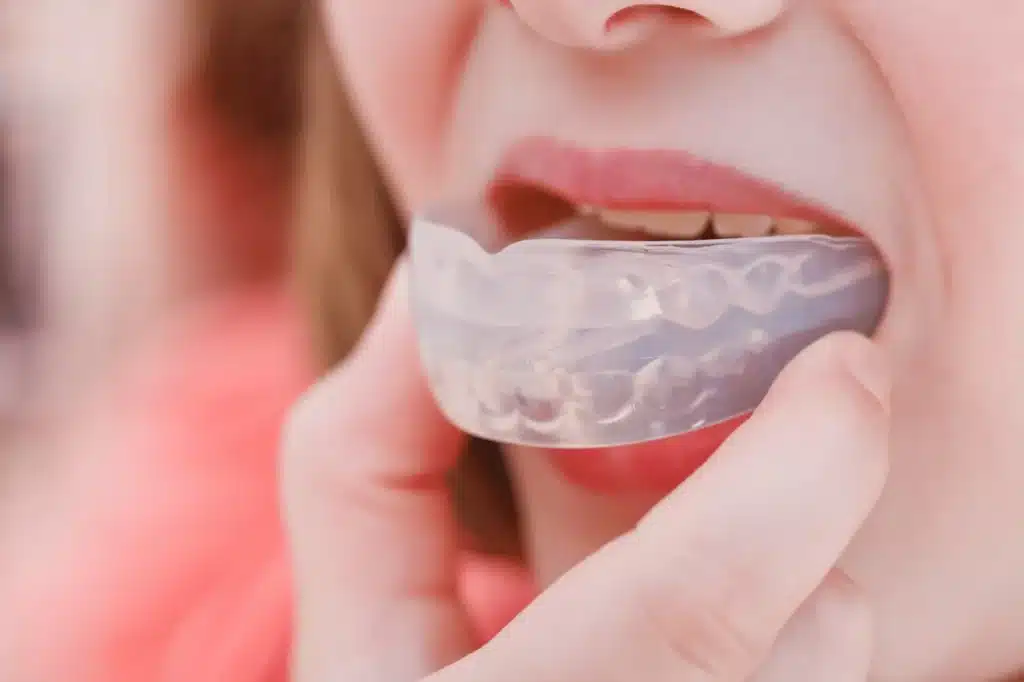 Nightguards To Prevent Teeth