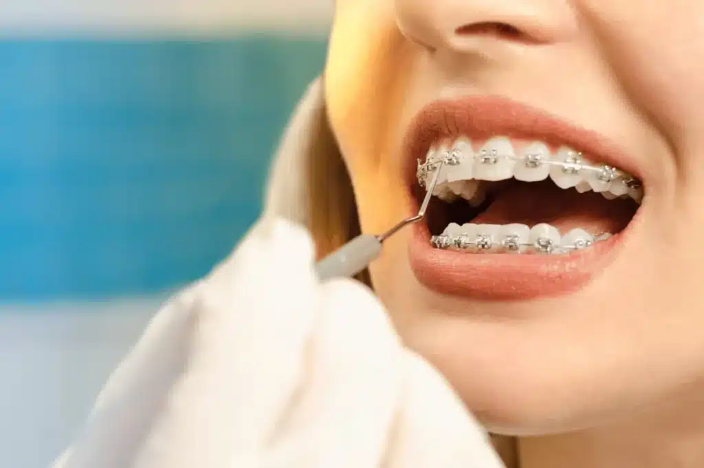 Patient Getting Braces Checked