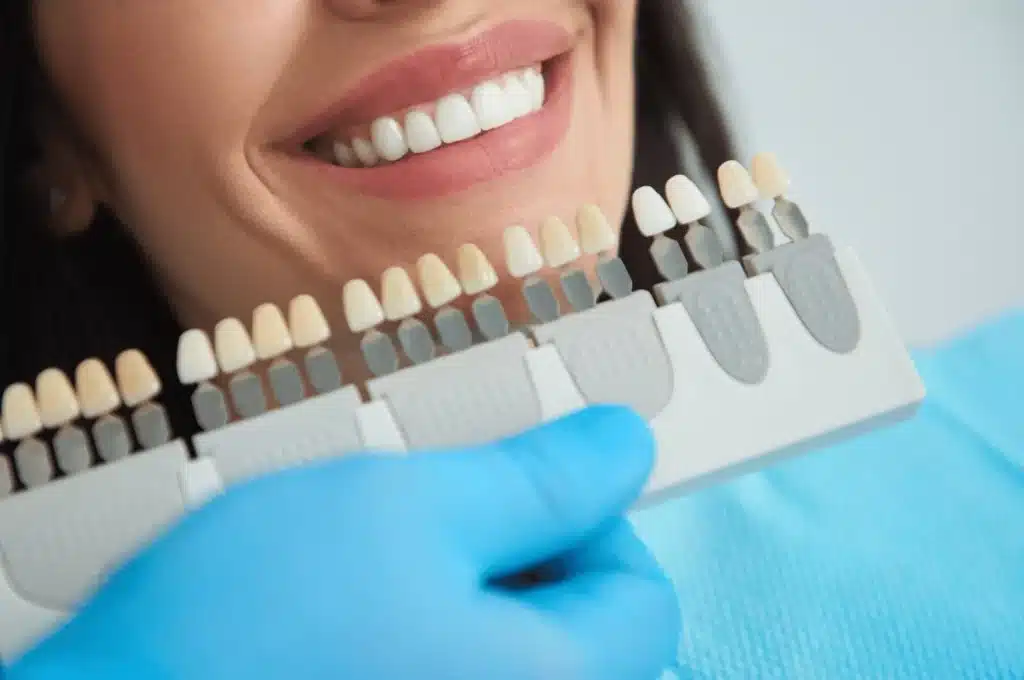 Dental Crowns To Protect Teeth